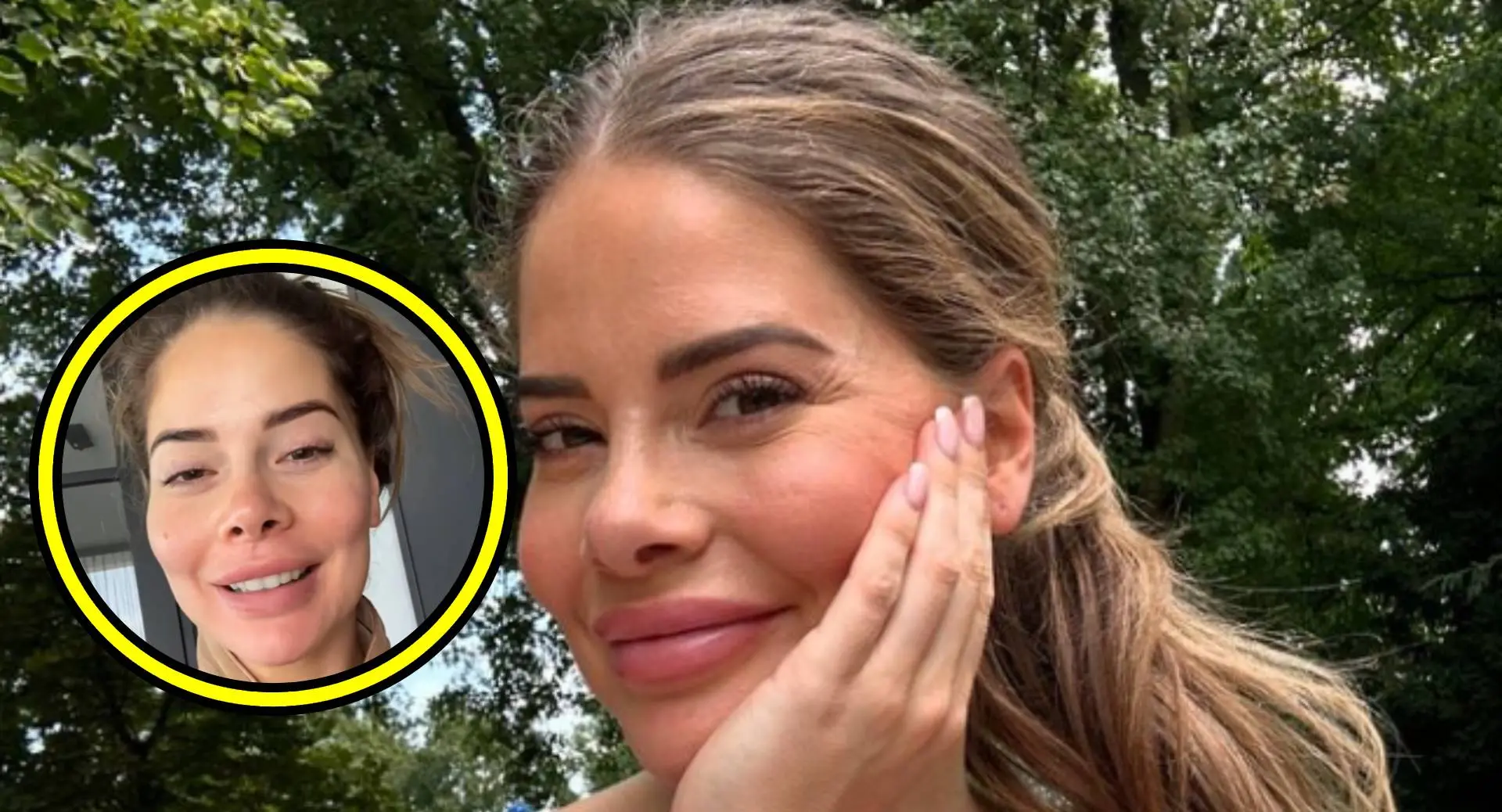 Schrik niet: Miss Nederland Stephanie Tency ging té ver met cosmetische ingrepen en dit is het resultaat (foto's!)