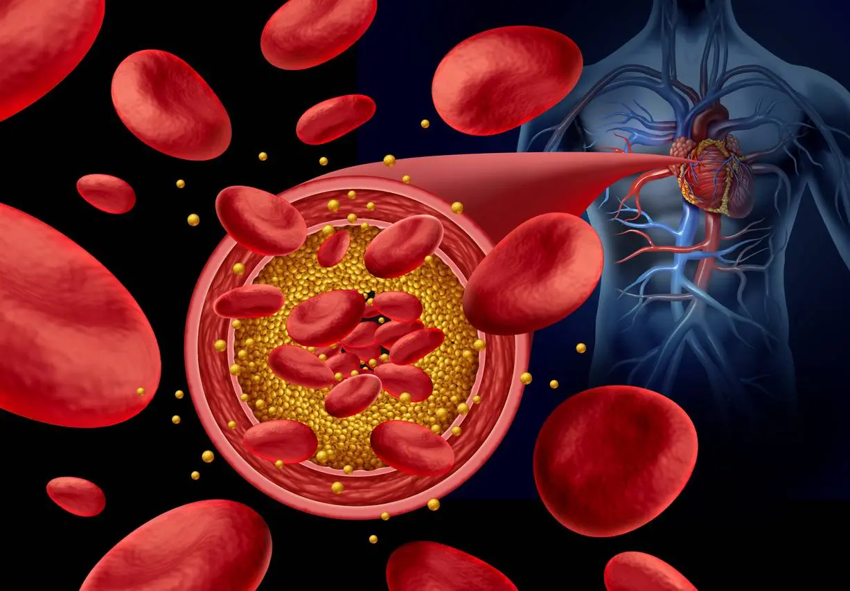 ACC Issues 2026 Scientific Statement on Antiplatelet Therapy in ASCVD