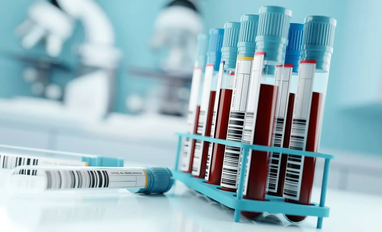 BCID2 Shortens Time to Effective Antimicrobial Changes