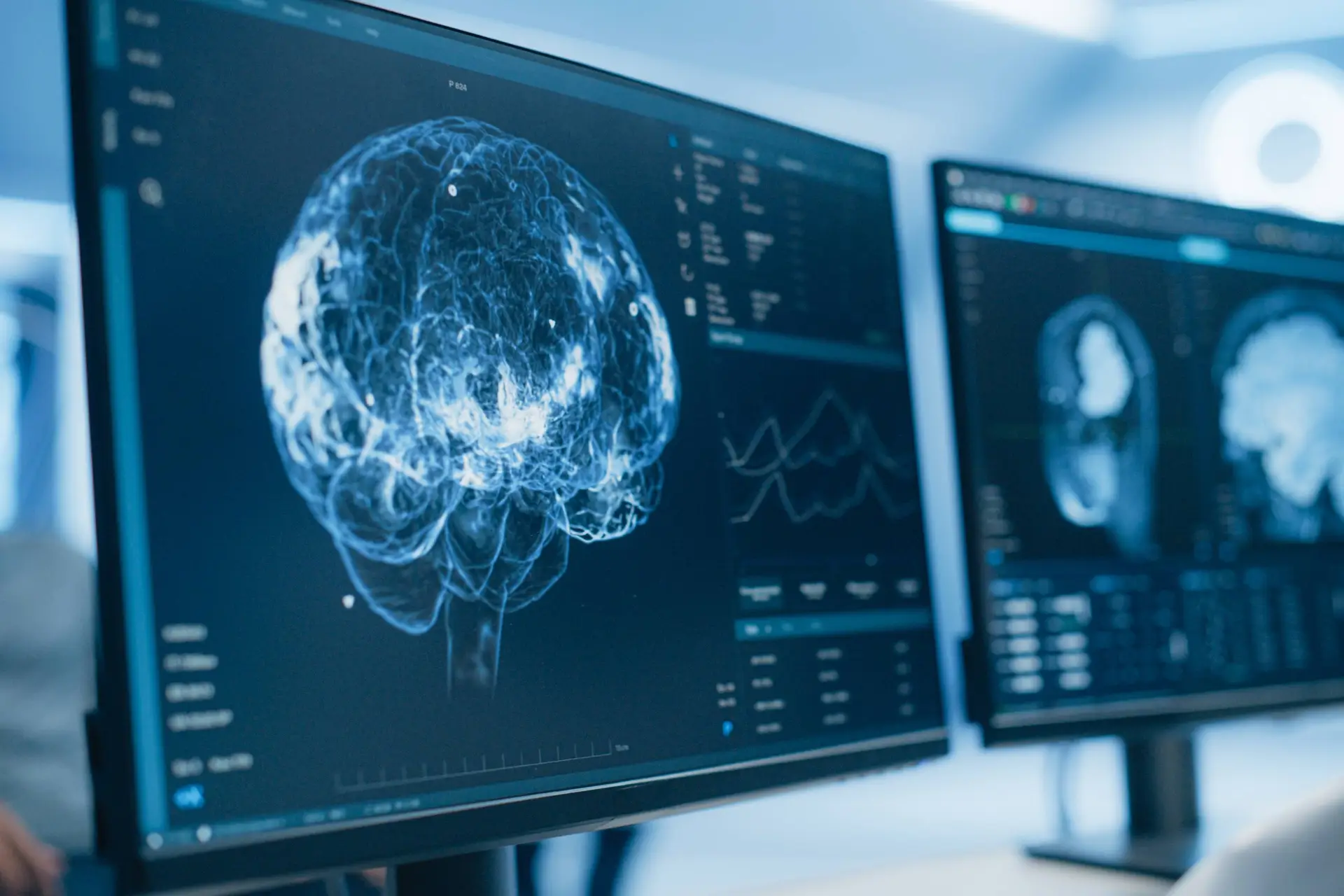 Thrombectomy Improved Outcomes After Transfer for Large-Core Stroke