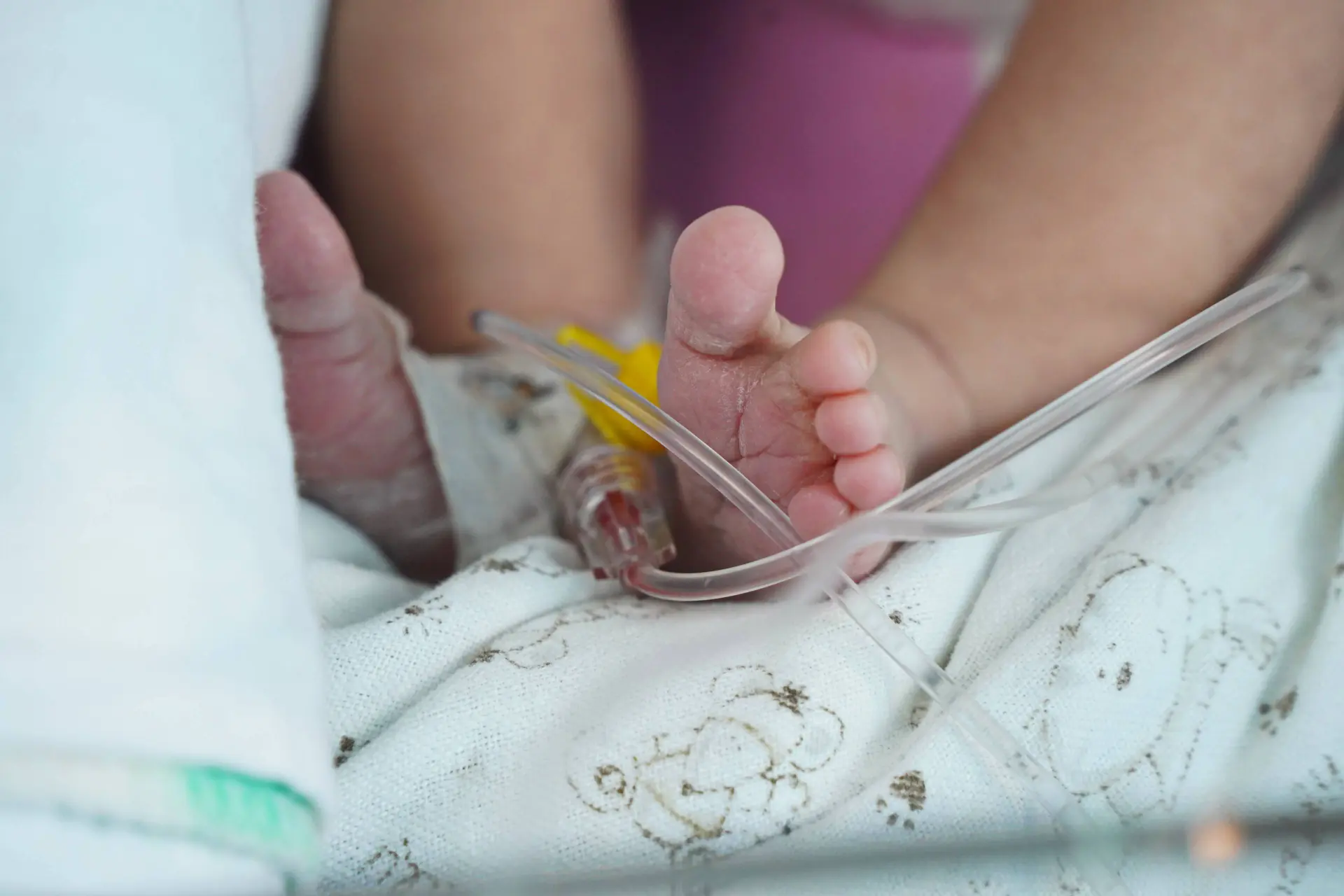 Organ Dysfunction Varies in Preterm Infant Bacteremia