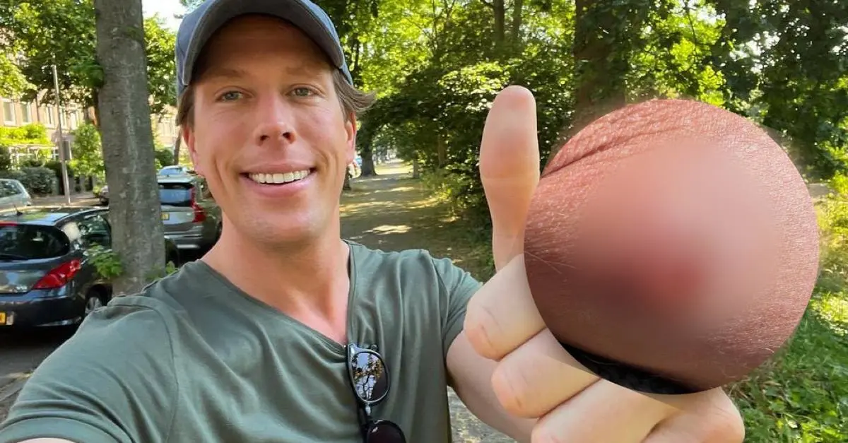 Freek Vonk toont gat in been: "Meer pijn dan ooit tevoren" (VIDEO)