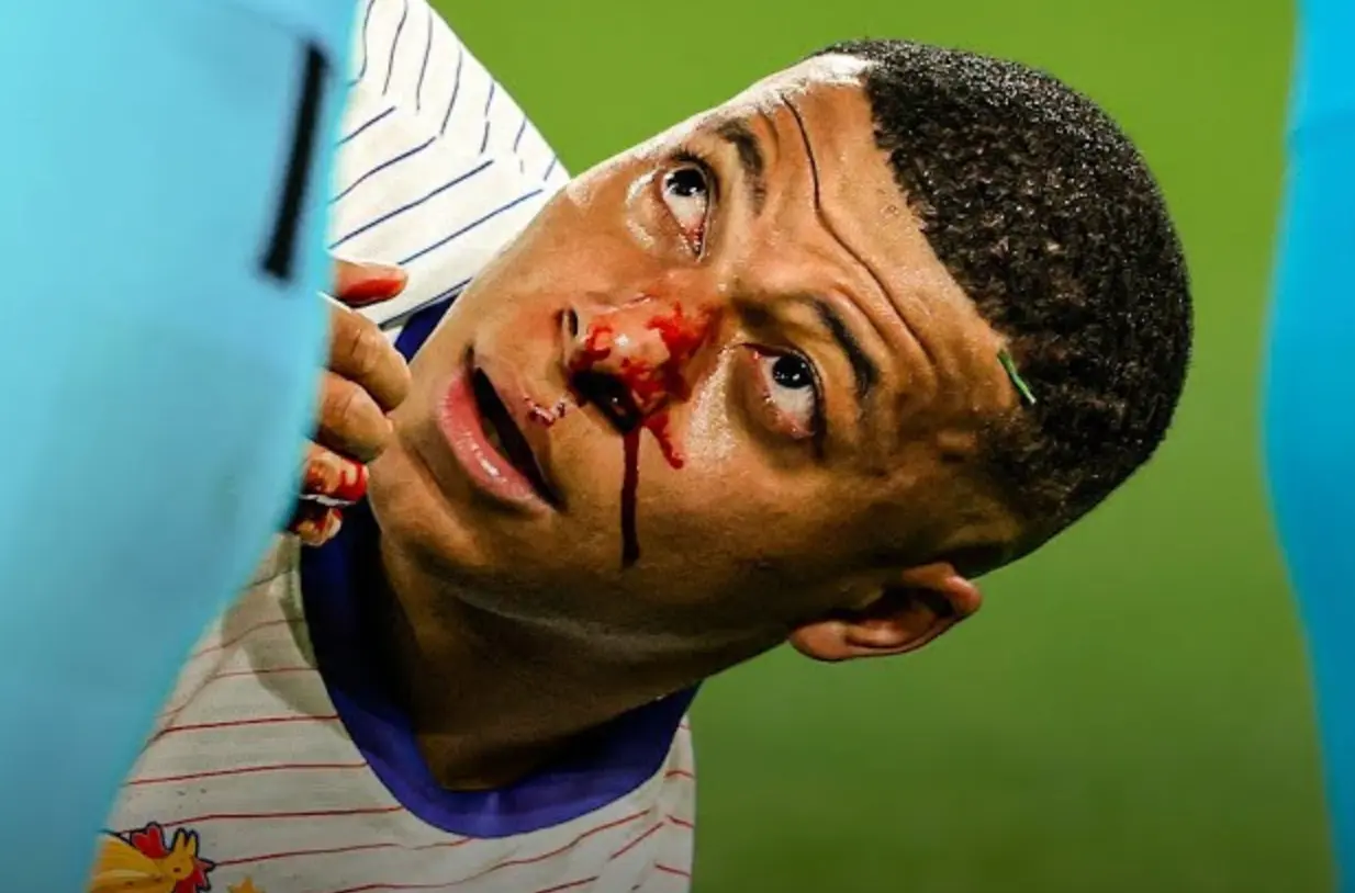 Kylian Mbappé onthult opmerkelijk masker na gebroken neus en lijkt hiermee klaar voor wedstrijd tegen Oranje