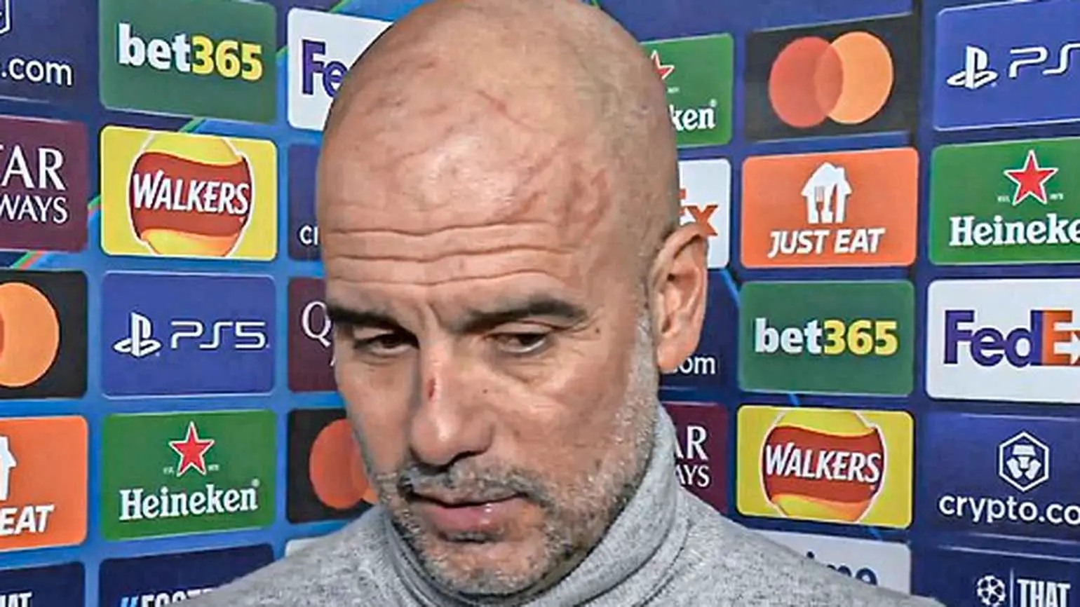 Manchester City-coach Guardiola verschijnt gewond voor de camera na bizarre comeback Feyenoord: "I want to harm myself"