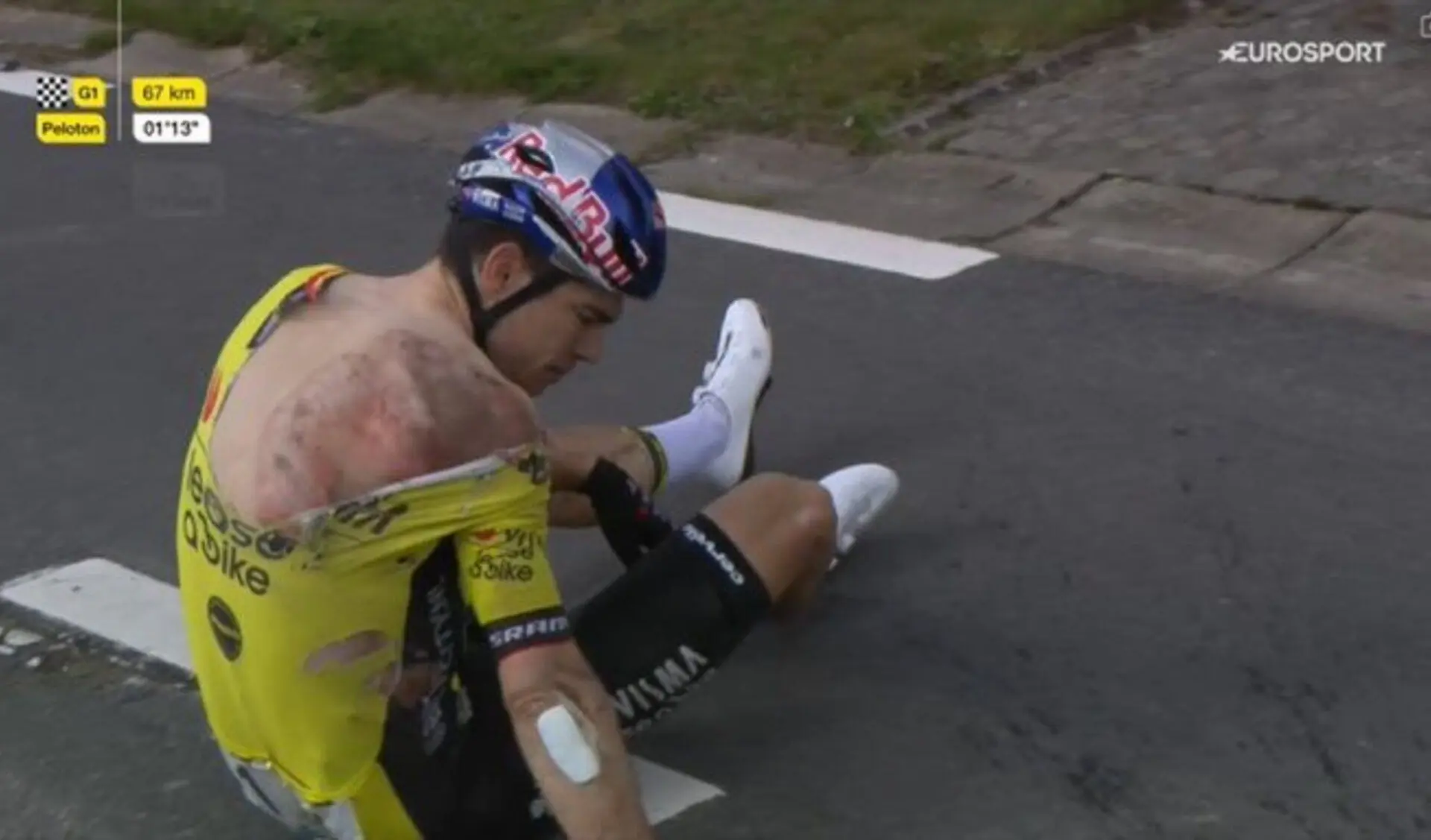 Die Enthüllung der geprellten Lunge vergrößert die Ungewissheit über die Rückkehr von Wout van Aert: "Der Scan wird erst in ein Paar Wochen stattfinden. Dann wissen wir, wie seine Situation wirklich ist."