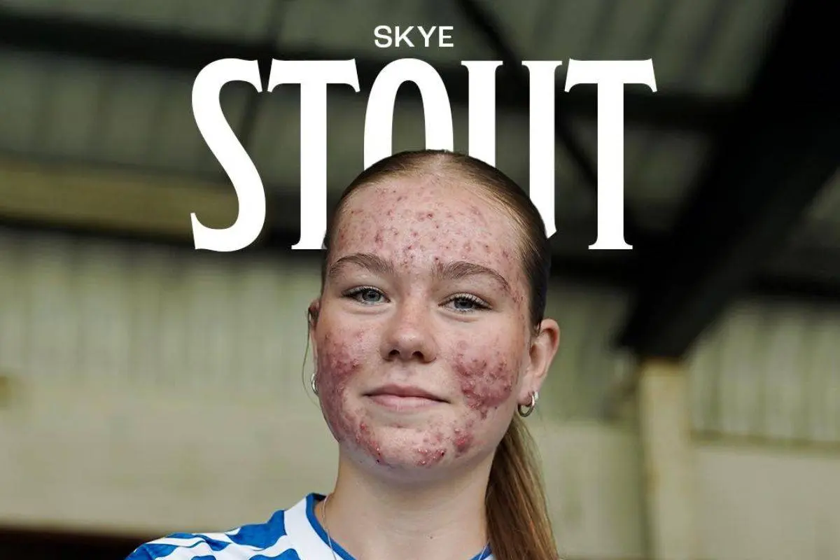 16-årigt talent mobbet på nettet efter at have underskrevet sin første kontrakt