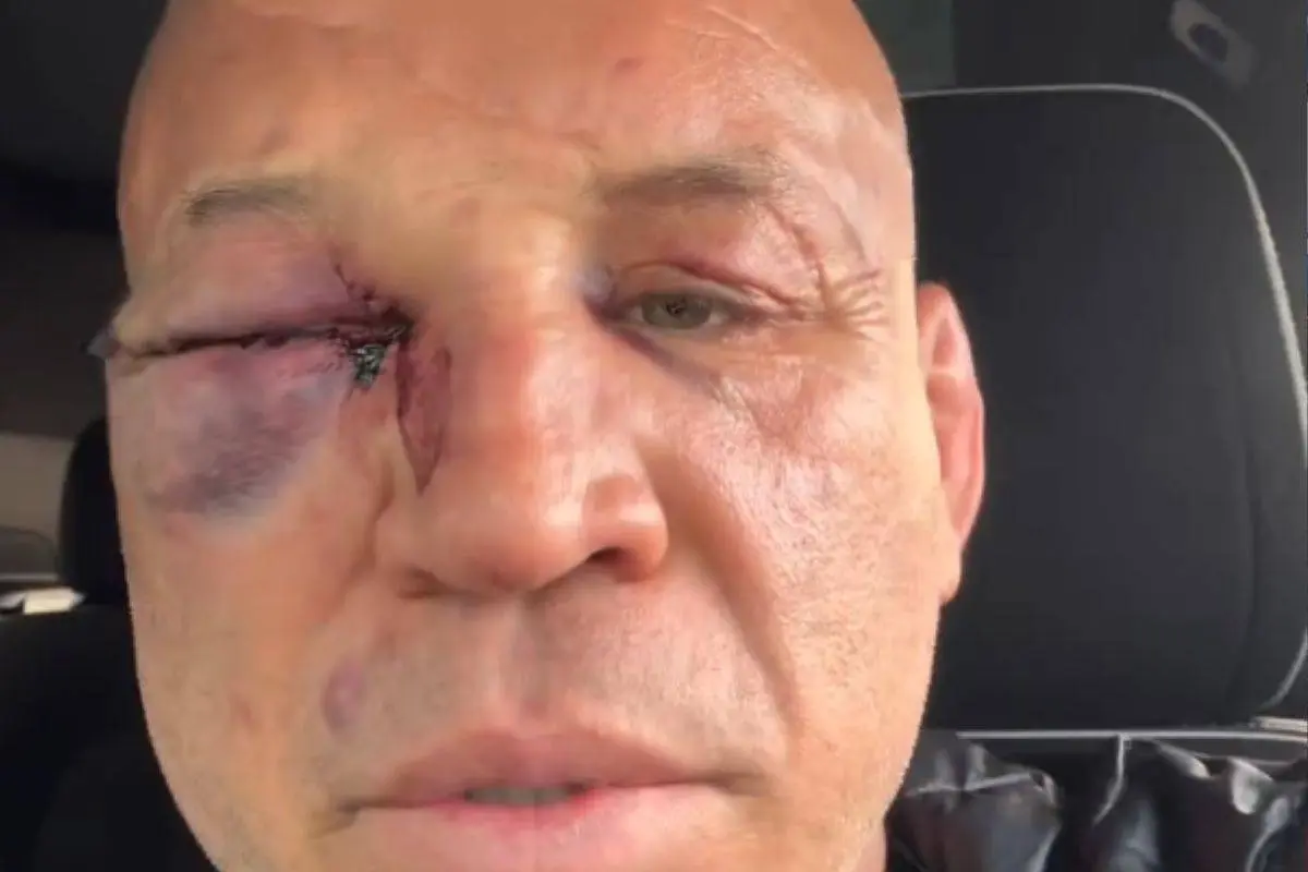 Wanderlei Silva