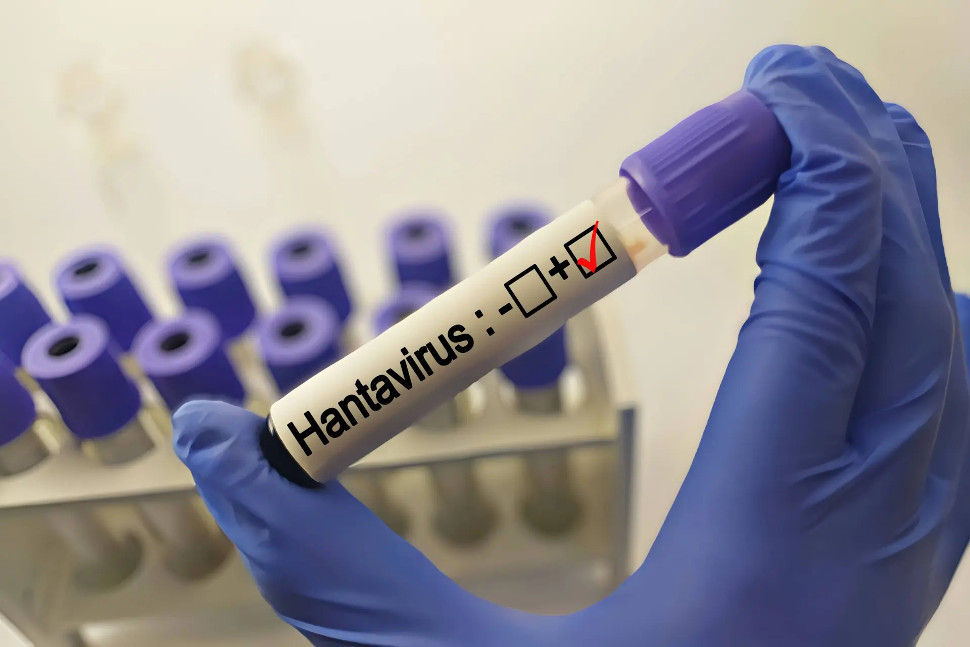 Waarom draait de Nederlandse belastingbetaler op voor de buitenlandse hantavirus-chaos?
