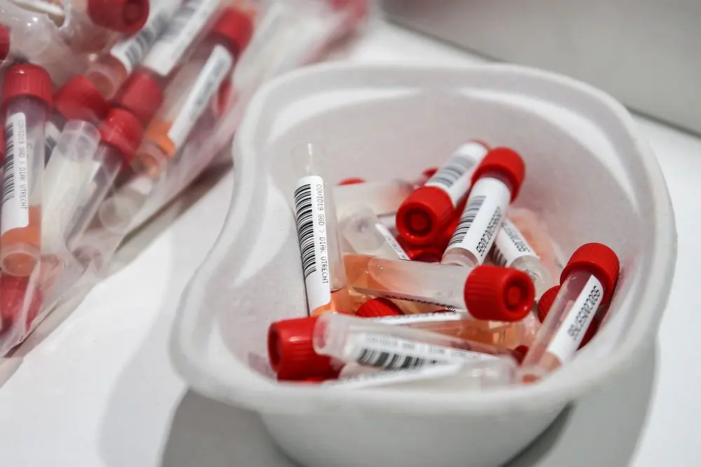coronatest 2020 buisjes