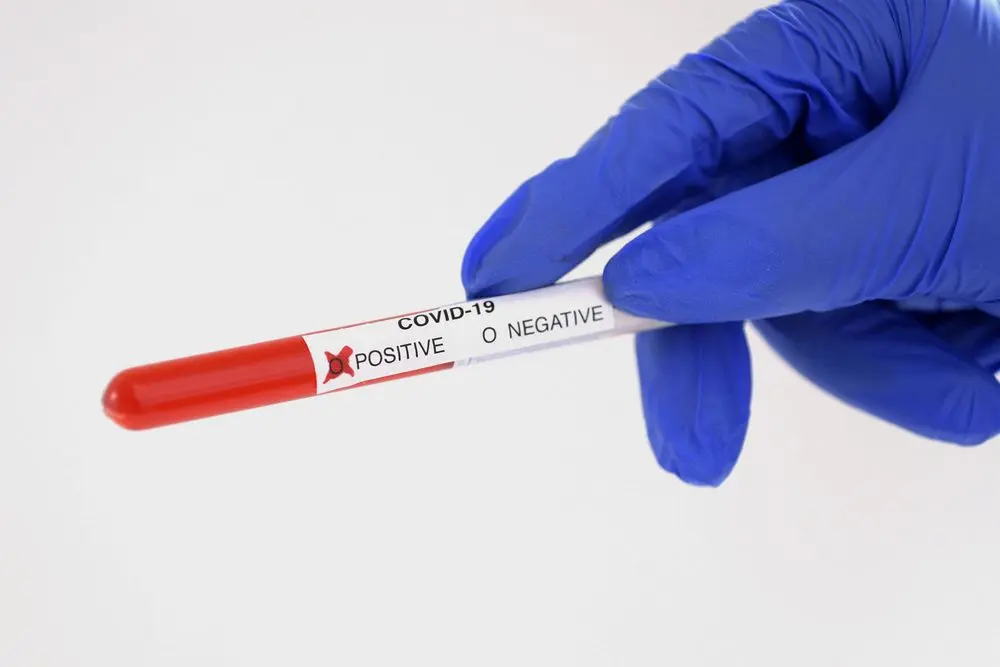 coronatest positief 2020
