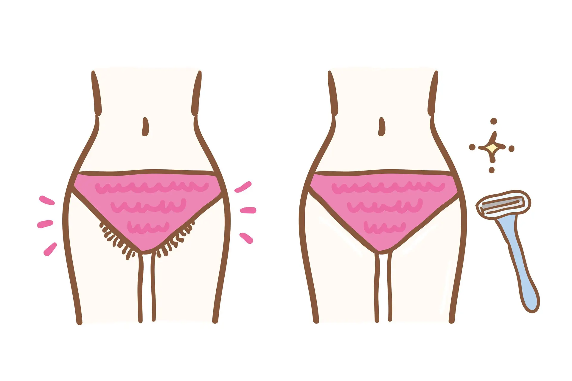 Is scheren van je vaginale streek echt hygiënischer?