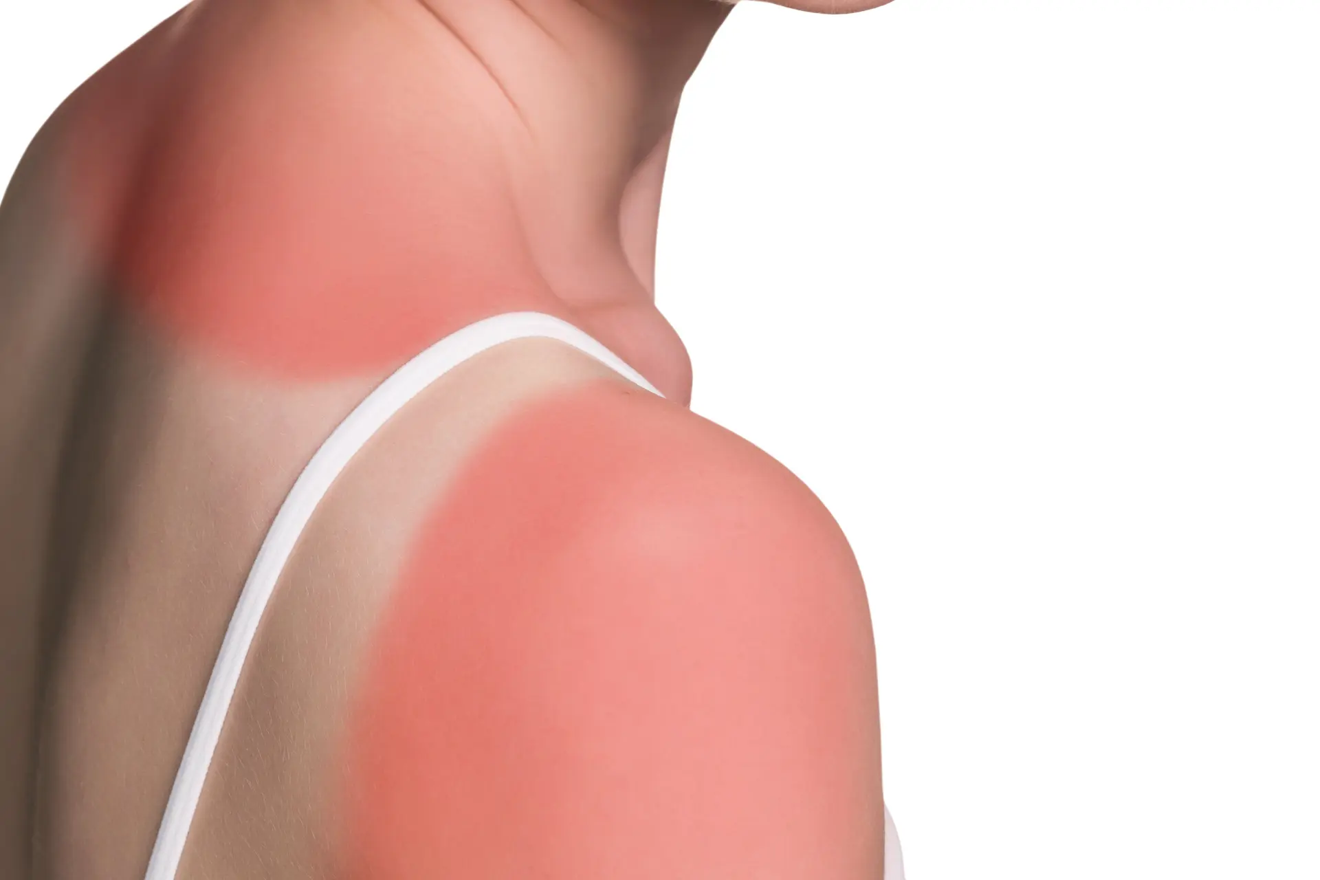 'Zonnebaden voor vitamine D is onzin'