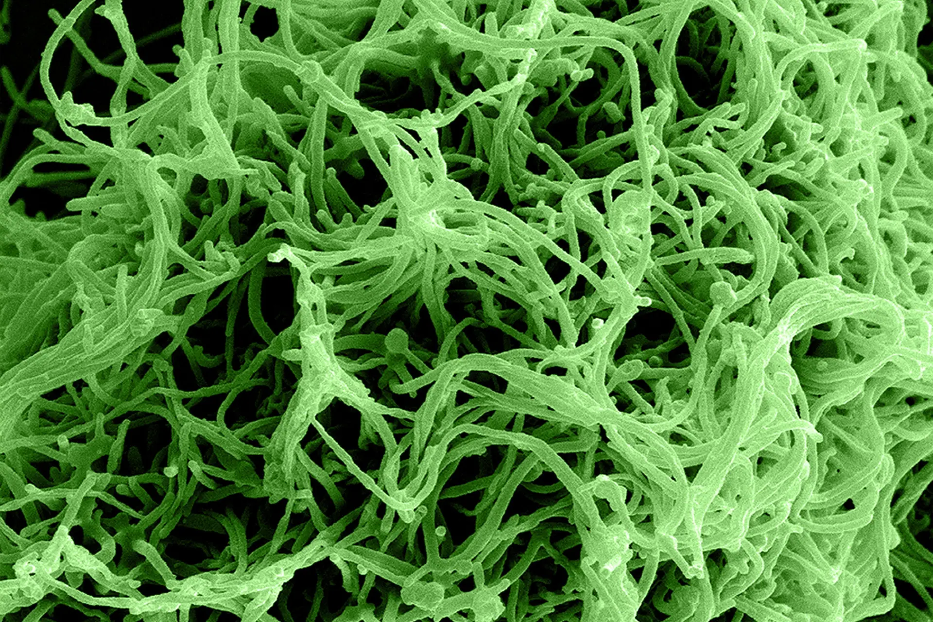 Ontdekker van Ebola waarschuwt voor apocalyptische ‘Ziekte X’: “We moeten allemaal bang zijn