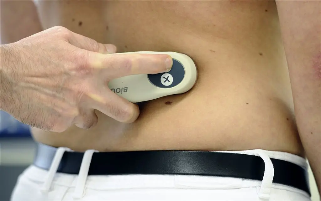 Met nieuwe scanner weet je binnen 30 seconden of je huidkanker hebt