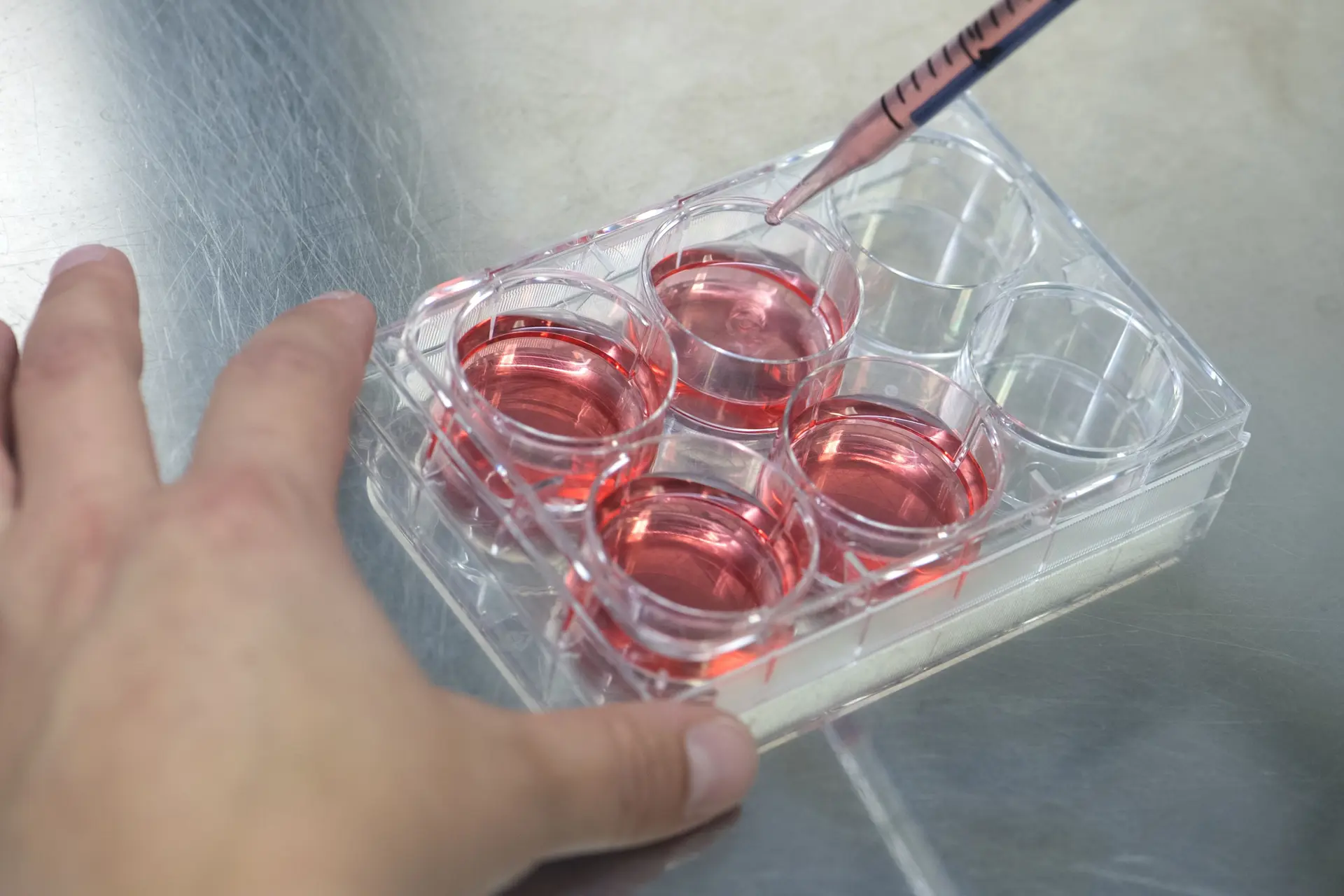 Arts met hersentumor test eigen experimentele behandeling: “Kanker nog niet terug”