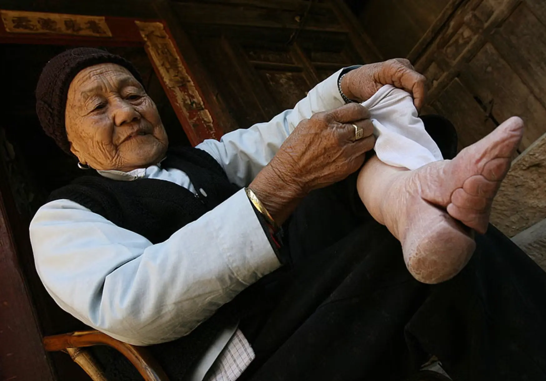 Schokkende foto's tonen de gruwel van het oude Chinese voetbinden