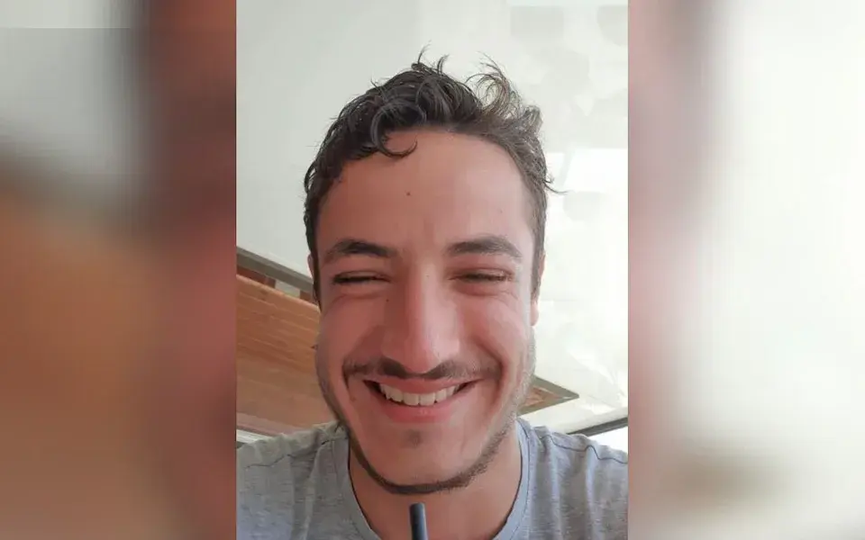 Mathieu (24) pleegt zelfmoord na mislukte baardtranspantatie door Turkse nep-chirurg