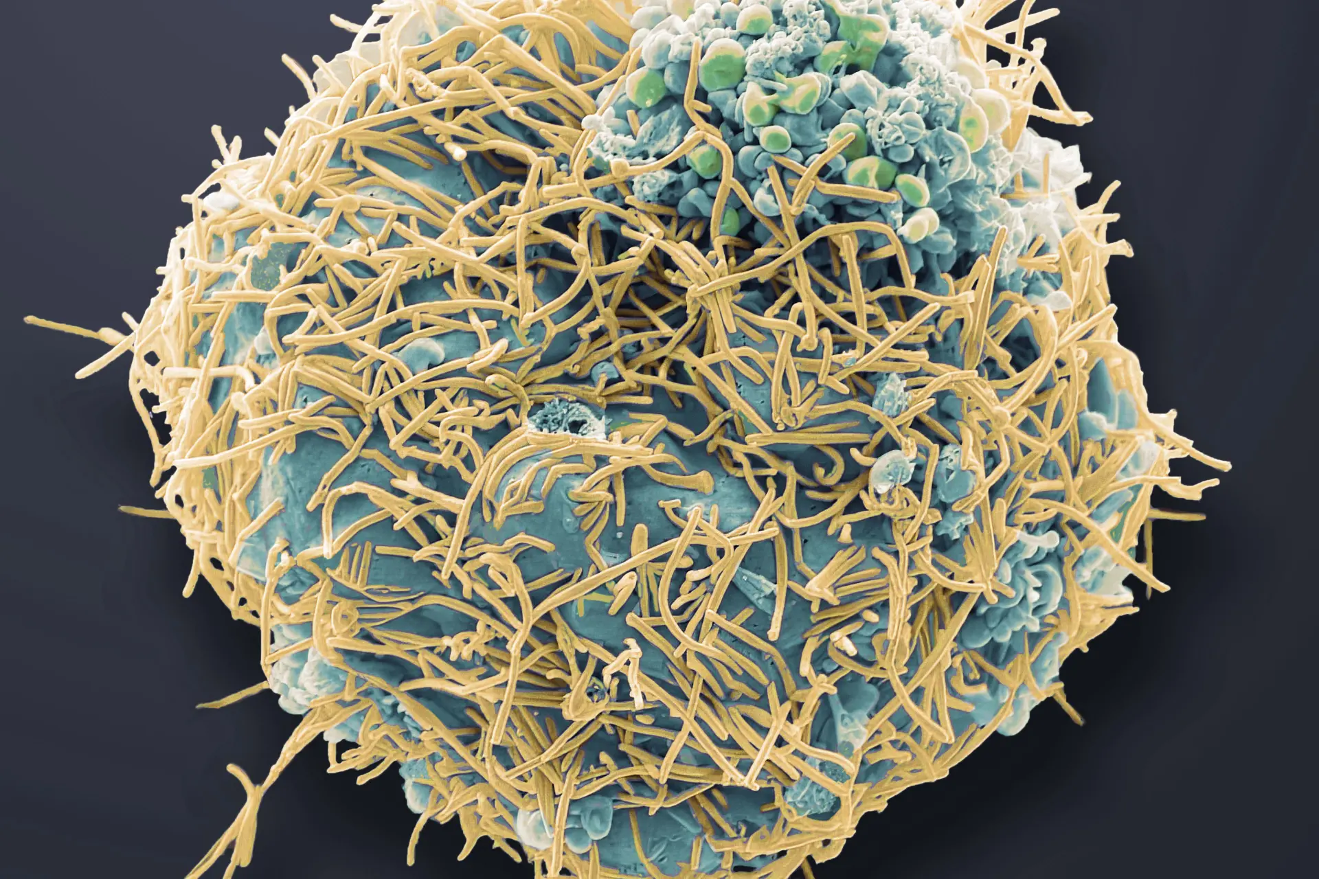 Wat is het humaan metapneumovirus (HMPV) dat om zich heen slaat in China, en moeten we ons zorgen maken?