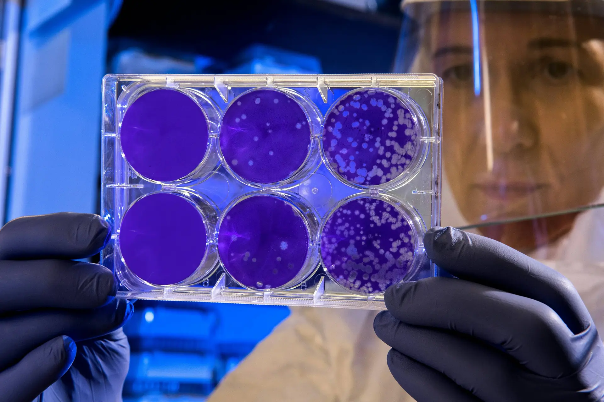 Eeuwenoude moordenaar wordt razendsnel resistent tegen antibiotica en verspreidt zich wereldwijd