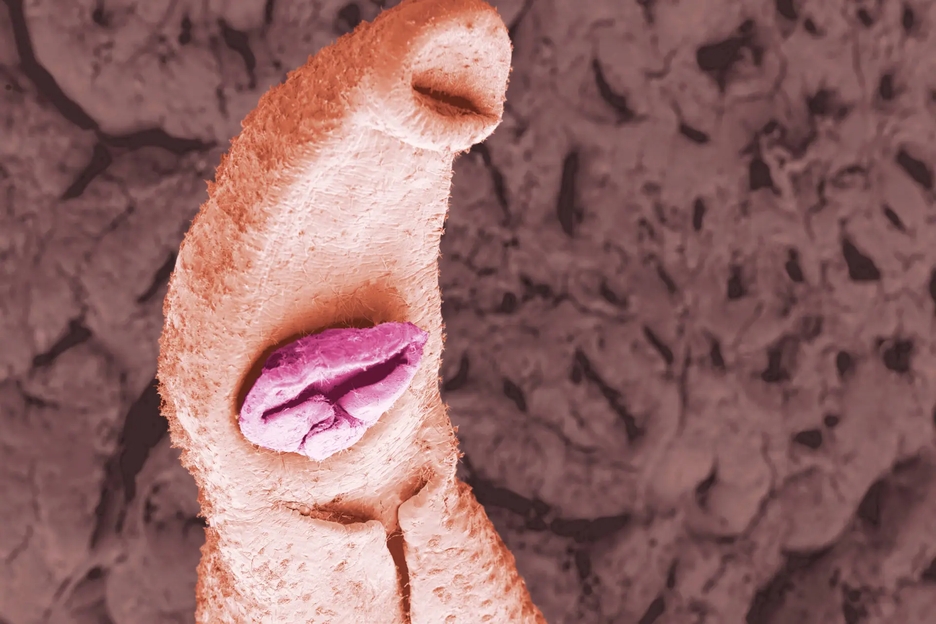 Gevaarlijke parasitaire worm kan orgaanfalen en kanker veroorzaken; rukt op naar Europa