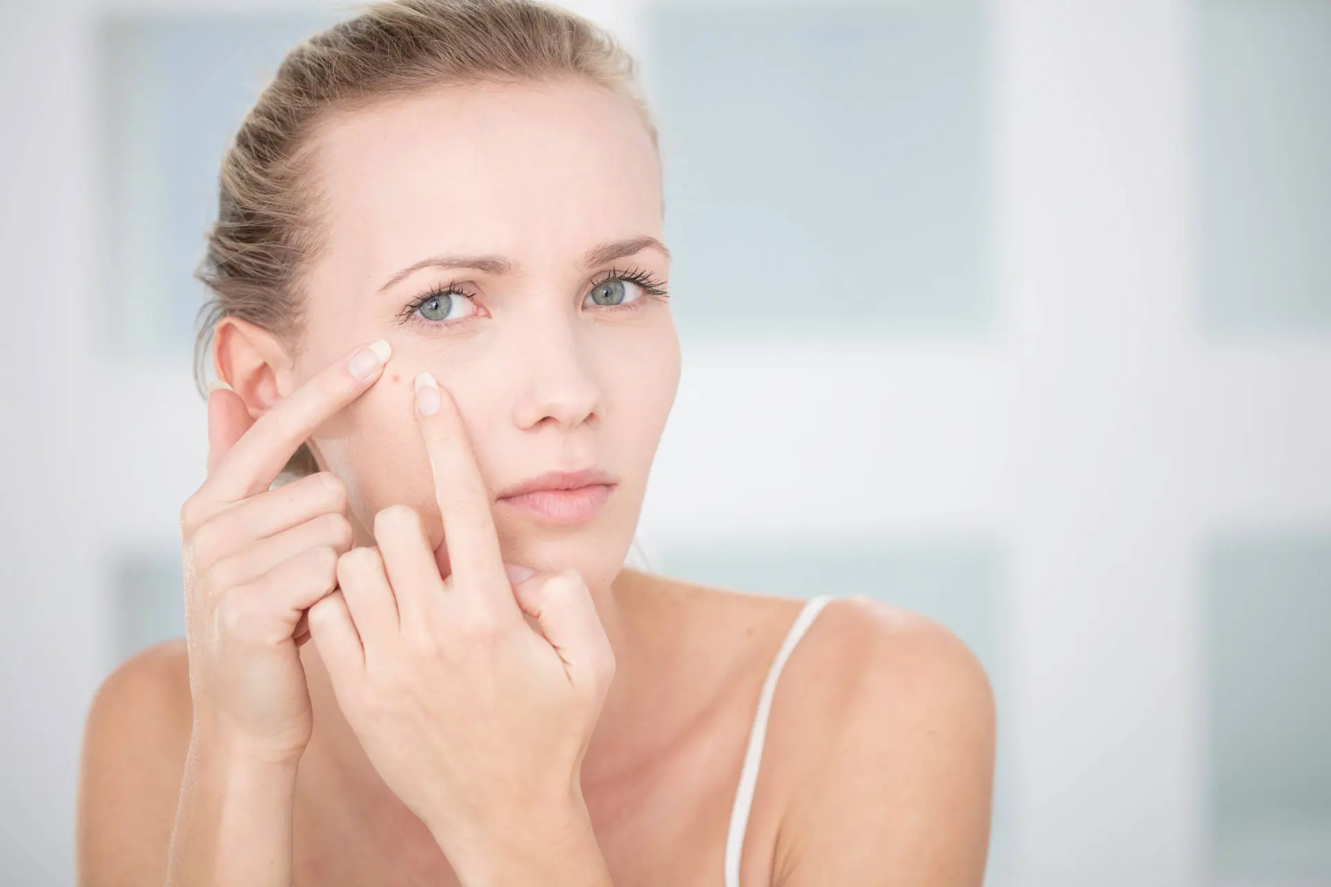 Waarom krijg je acne en wat kun je eraan doen?