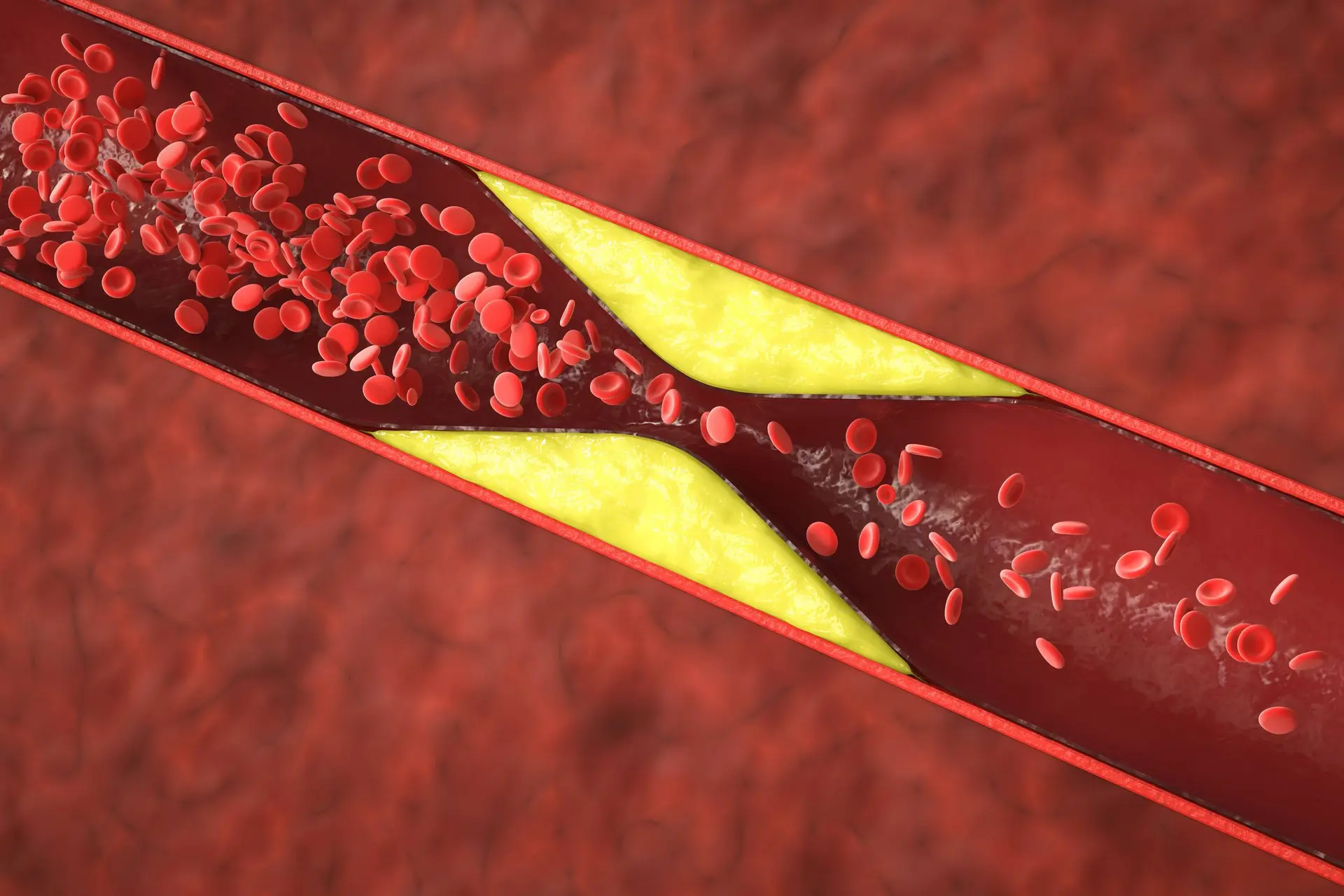 Nieuwe behandeling halveert cholesterol zonder bijwerkingen