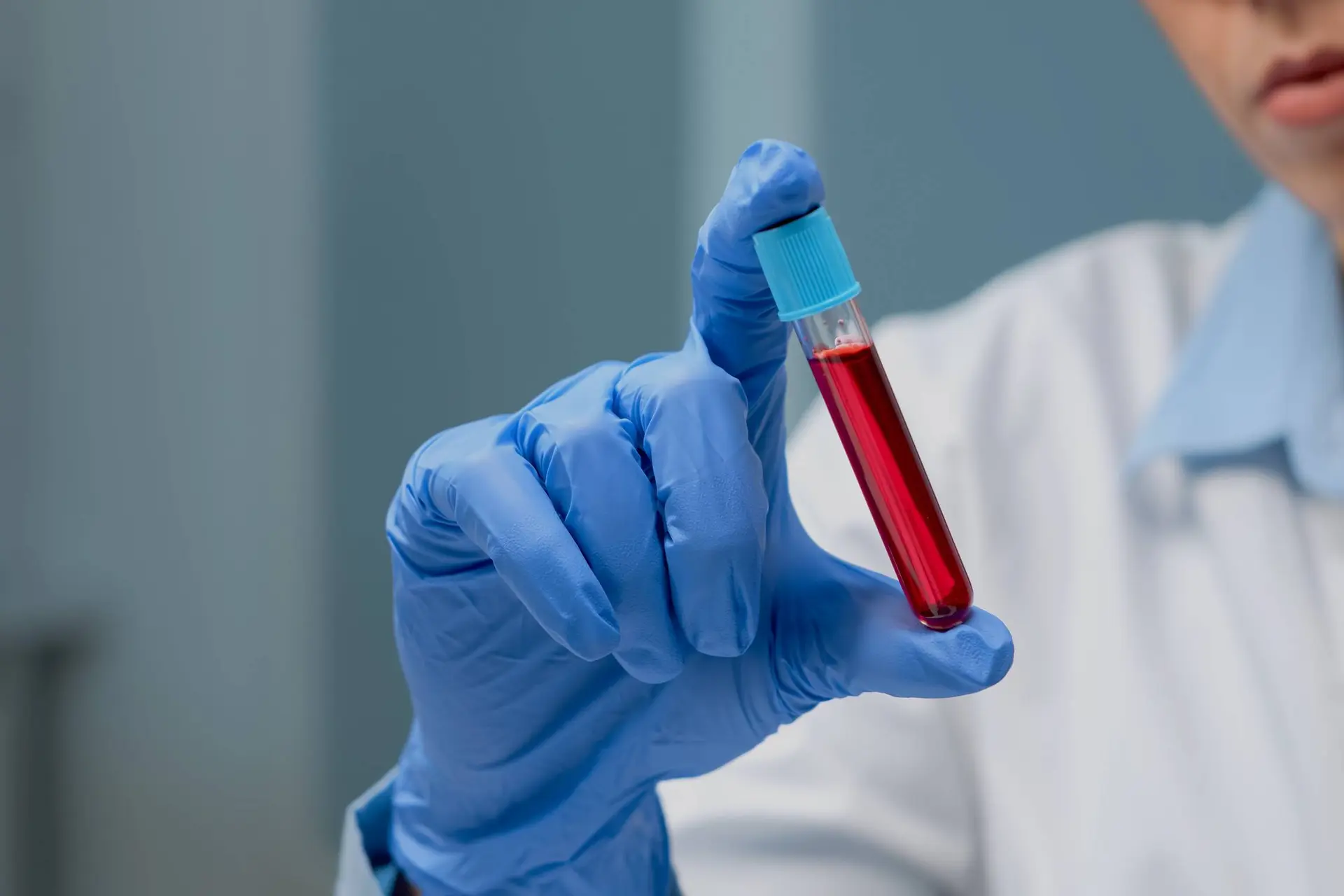 Bloedtest spoort meer dan 50 soorten kanker op