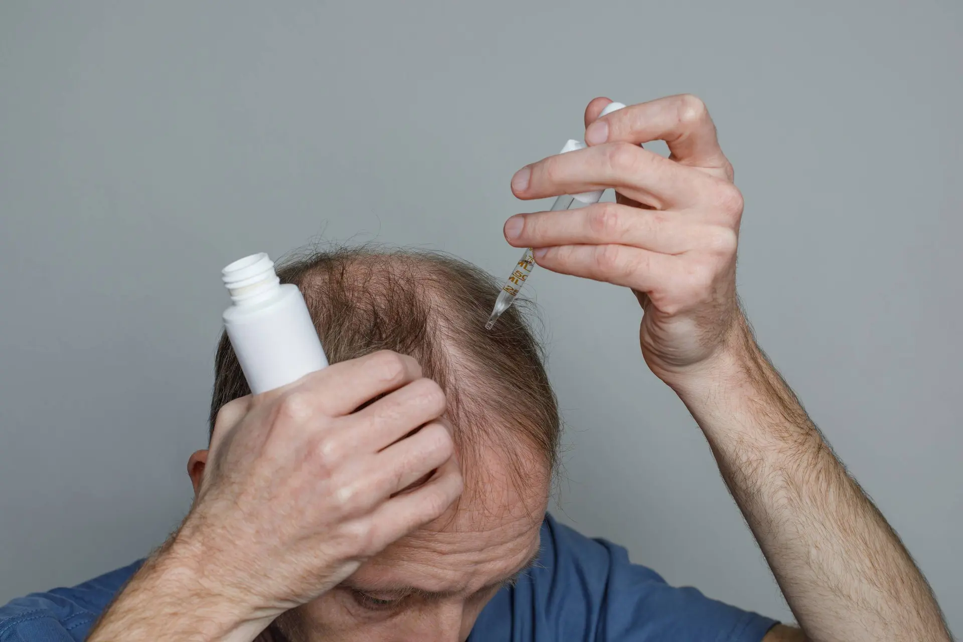 Deze natuurlijke zoetstof zou een onverwachte bondgenoot kunnen zijn tegen haaruitval
