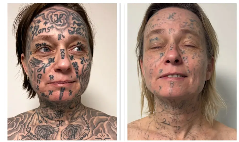 Ex dwong Joke tot 250 tatoeages – van de rechter mag dat