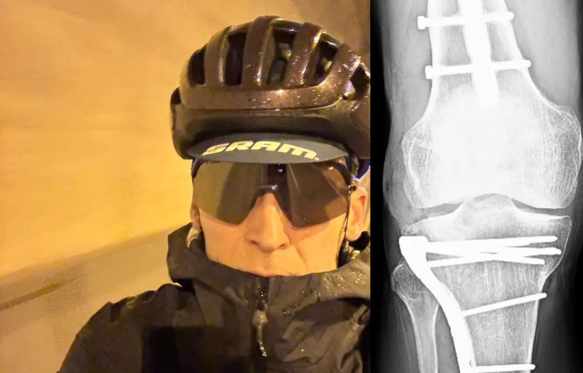 robert-gesink-knie
