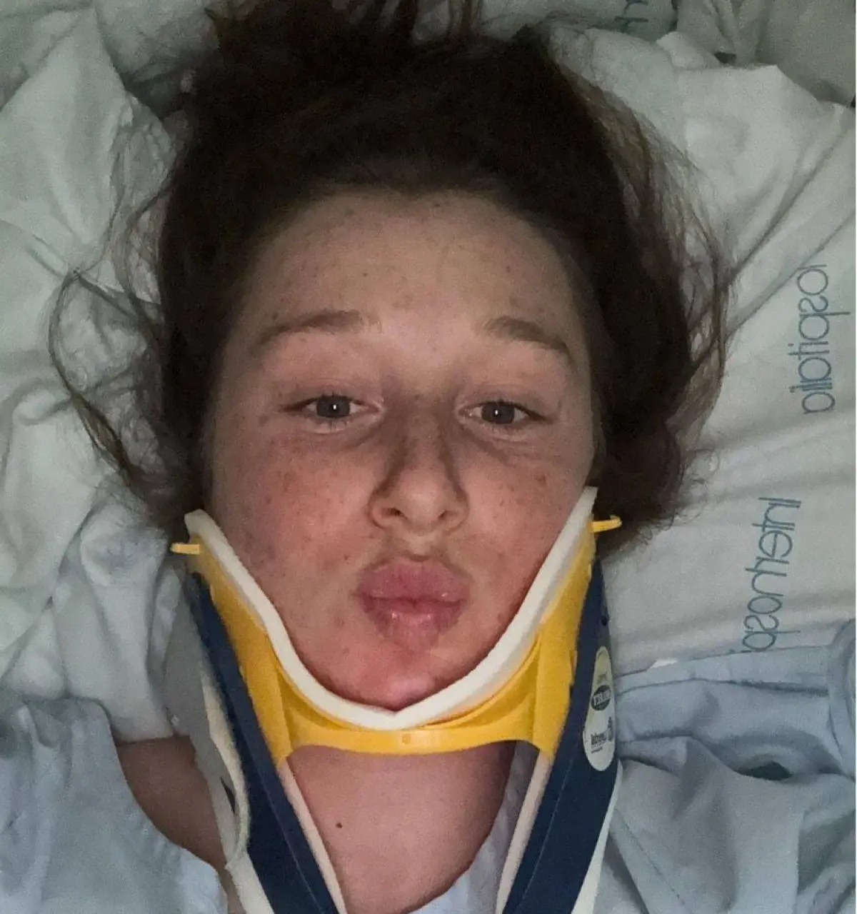 Visma | Lease a Bike rider suffers 'frightening collision' in Spain: 'I was incredibly lucky'