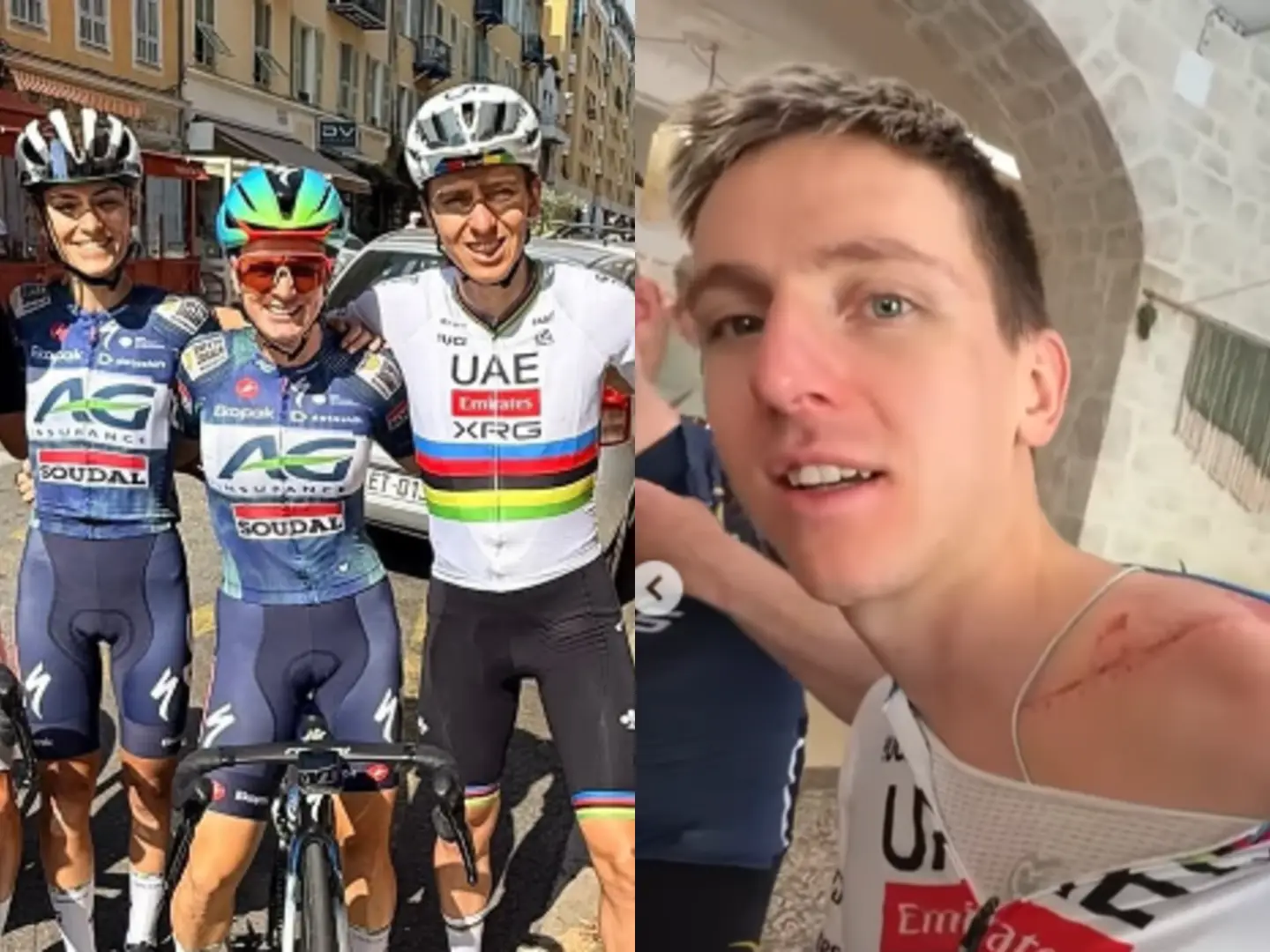 'First day back, last in the rainbow'; Pogačar shows off his scars on his first ride back on the bike