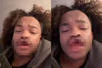 Man heeft geen lipfillers, maar wel een avondje Korte Leidsedwarsstraat achter de rug