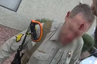 Hulpagent overleeft machete-aanval en schiet aanvaller in zijn gezicht in Las Vegas