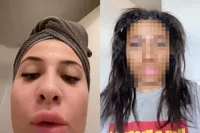 TikTokster gaat compleet mis met zelfbruiner en verandert in Oempa Loempa