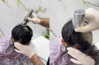 Jeuk op het hoofd blijkt een compleet horrorverhaal