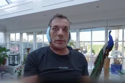 Gerard Joling deelt eerste beelden na schokkende gezichtsoperatie