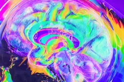 AI voorspelt kans op herstel bij psychose nauwkeuriger dankzij UMC Utrecht