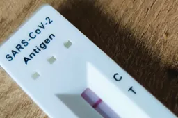 Kovidui diagnozuoti galios ir greitieji testai