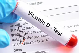 Kraujo tyrimas nebūtinai parodo tikrąjį vitamino D poreikį jūsų organizmui