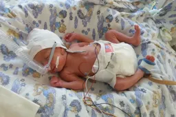 Tris mėnesius dėl gyvybės kovojusį ankstuką Ąžuolą mama vadina stebuklu