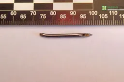 Restorane prie Druskininkų pietavusi moteris: „Kepsnyje radau... adatą“