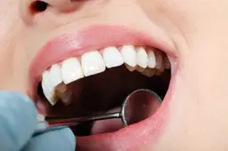Alytaus apskrities odontologai slapčia lobo iš tūkstančius kainuojančių procedūrų