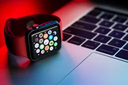 Apple Watch laikrodžio priežiūra ir remontas