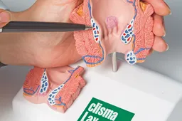 Kas yra apyvarpės uždegimas? Dažniausiai pasitaikančios ligos