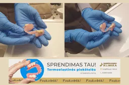 Vasaros akcija – elastinės plokštelės už paprastų kainą!