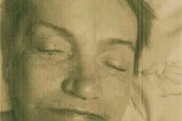 Prašo atpažinti Alytuje komos būsenoje rastą moterį