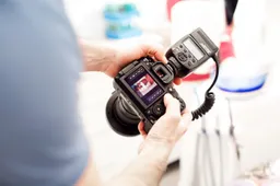 Dažniausiai užduodami klausimai apie burnos higieną ir BŠP procedūrą