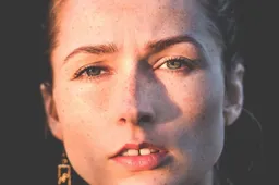 Priežastys, dėl kurių gali išberti veido odą