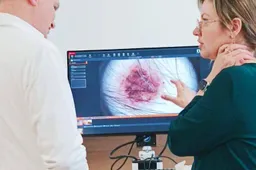 Alytaus ligoninėje – naujos, inovatyvios odos vėžio diagnostikos ir gydymo galimybės